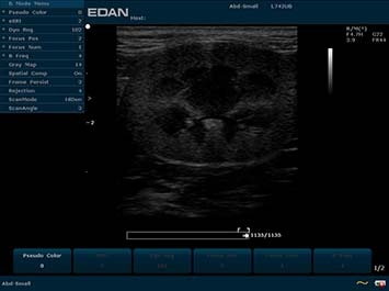 EDAN U2 VET