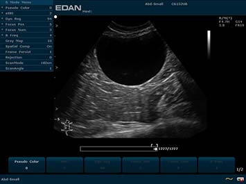 EDAN U2 VET
