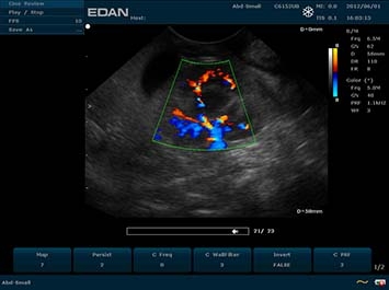 EDAN U50 VET