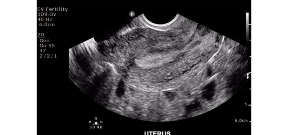 Philips ClearVue 650