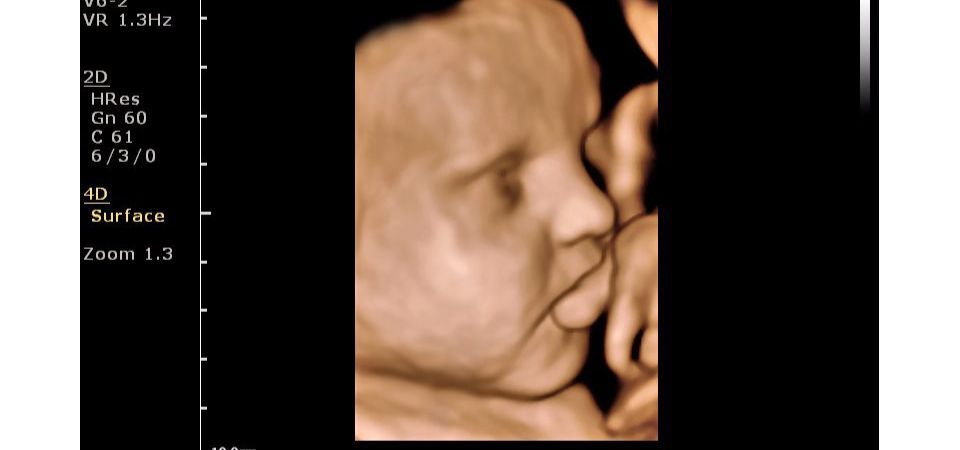 Philips ClearVue 650