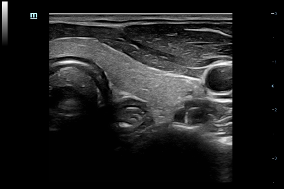 Mindray DC-60 Exp X-Insight